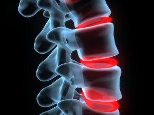 letselschadebedrag en schadevergoeding
