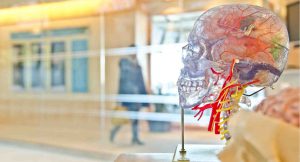 smartengeld hersenschudding, smartengeld hersenkneuzing